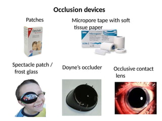 Patches Micropore tape with soft
tissue paper
Spectacle patch /
frost glass
Doyne’s occluder
Occlusion devices
Occlusive contact
lens
 