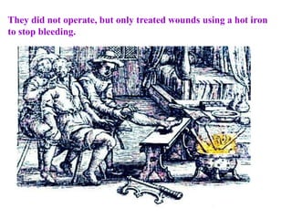 They did not operate, but only treated wounds using a hot iron
to stop bleeding.
 