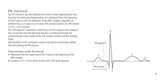 11
PR interval
The PR interval is the time between the onset of atrial depolarisation and
the onset of ventricular depolarisation. It is measured from the beginning
of the P wave to the first deflection of the QRS complex; regardless of
whether this is a Q wave or an R wave.The normal duration of a PR interval
is 0.12 – 0.22 seconds.
The “PR segment” represents a brief return of the P wave to the isoelectric
line. During this time the electrical impulse is conducted through the
atrioventricular node, bundle of His, the bundle branches and the Purkinje
fibres.
Abnormalities of the conduction system may lead to transmission delays
that will prolong the PR interval.
Characteristics of the PR interval
•	 Measured from the beginning of the P wave to the beginning of the
QRS complex
•	 Duration 0.12 – 0.22 s (three to five and a half small squares)
P
PR segment
PR interval Q
R
S
T
U
 