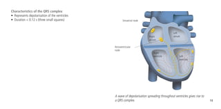 13
Characteristics of the QRS complex
•	 Represents depolarisation of the ventricles
•	 Duration < 0.12 s (three small squares) Sinoatrial node
Atrioventricular
node
Right
atrium
Left
atrium
Right
ventricle Left
ventricle
A wave of depolarisation spreading throughout ventricles gives rise to
a QRS complex.
 