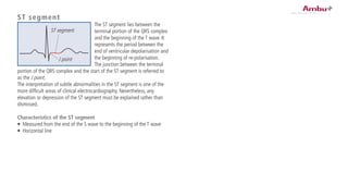 ST segment
The ST segment lies between the
terminal portion of the QRS complex
and the beginning of the T wave. It
represents the period between the
end of ventricular depolarisation and
the beginning of re-polarisation.
The junction between the terminal
portion of the QRS complex and the start of the ST segment is referred to
as the J point.
The interpretation of subtle abnormalities in the ST segment is one of the
more difficult areas of clinical electrocardiography. Nevertheless, any
elevation or depression of the ST segment must be explained rather than
dismissed.
Characteristics of the ST segment
•	 Measured from the end of the S wave to the beginning of the T wave
•	 Horizontal line
ST segment
J point
 