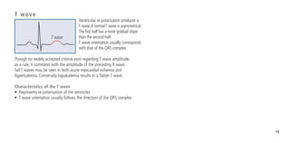 15
T wave
Ventricular re-polarisation produces a
T wave.A normalT wave is asymmetrical.
The first half has a more gradual slope
than the second half.
T wave orientation usually corresponds
with that of the QRS complex.
Though no widely accepted criteria exist regarding T wave amplitude,
as a rule, it correlates with the amplitude of the preceding R wave.
Tall T waves may be seen in both acute myocardial ischemia and
hyperkalemia. Conversely hypokalemia results in a flatter T wave.
Characteristics of the T wave
•	 Represents re-polarisation of the ventricles
•	 T wave orientation usually follows the direction of the QRS complex
T wave
 