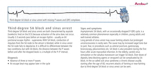 Third-degree SA block and sinus arrest
Third-degree SA block and sinus arrest are both characterised by asystole
(isoelectric line) on the ECG because activation of the atria does not occur.
Usually 2-3 seconds pass before an escape rhythm - usually an AV
junctional escape rhythm - supervenes.With SA block, conduction of
impulses from the SA node to the atrium is blocked, while in sinus arrest
the SA node fails to depolarise. It is difficult to differentiate between the
two conditions, but with SA block, the distance between the P waves
before and after the dropped beats is a multiple of the P–P interval.
Diagnosis
•	 Absence of three or more P waves
•	 An escape beat may appear later in the cycle
Signs and symptoms
Asymptomatic SA block, with an occasionally dropped P-QRS cycle, is a
relatively common phenomenon especially in children, young adults and
well-trained athletes.
Long periods of sinus arrest may cause fainting attacks but prolonged
unconsciousness is rarely seen.The cause may by increased vagal tone due
to pain, fear, or procedures such as arterial puncture, gastroscopy,
broncoscopy, pleurocentesis etc. SA block is also prevalent during the first
hours after acute myocardial infarction. In the elderly, carotid sinus
stimulation or the valsalva manoeuvre can trigger SA block. Over doses of
digitalis, beta blocking agents or verapamil can be complicated by SA
block. In the so-called sick sinus syndrome, a chronic disease usually
starting after the age of 60, recurrent attacks of fainting or near-fainting
due to third-degree SA block or sinus arrest can be seen.
Third-degree SA block or sinus arrest with missing P waves and QRS complexes.
 