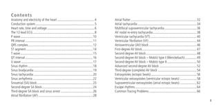 3
Contents
Anatomy and electricity of the heart.............................................4
Conduction system.......................................................................5
Heart rate, time and voltage.........................................................6
The 12-lead ECG..........................................................................8
P wave.......................................................................................10
PR interval.................................................................................11
QRS complex..............................................................................12
ST segment................................................................................14
T wave.......................................................................................15
QT interval.................................................................................16
U wave......................................................................................17
Sinus rhythm..............................................................................18
Sinus bradycardia.......................................................................19
Sinus tachycardia.......................................................................20
Sinus arrhythmia........................................................................22
Sinoatrial (SA) block...................................................................23
Second-degree SA block.............................................................24
Third-degree SA block and sinus arrest.......................................26
Atrial fibrillation (AF)..................................................................28
Atrial flutter...............................................................................32
Atrial tachycardia.......................................................................34
Multifocal supraventricular tachycardia.......................................36
AV nodal re-entry tachycardia.....................................................38
Ventricular tachycardia (VT)........................................................40
Ventricular fibrillation (VF)..........................................................44
Atrioventricular (AV) block..........................................................46
First-degree AV block..................................................................47
Second-degree AV block.............................................................48
Second-degree AV block – Mobitz type I (Wenckebach)...............49
Second-degree AV block – Mobitz type II....................................50
Advanced second-degree AV block.............................................52
Third-degree (complete) AV block...............................................54
Extrasystoles (ectopic beats).......................................................56
Ventricular extrasystoles (ventricular ectopic beats).....................58
Supraventricular extrasystoles (atrial ectopic beats).....................62
Escape rhythms..........................................................................64
Common Tracing Problems.........................................................66
 