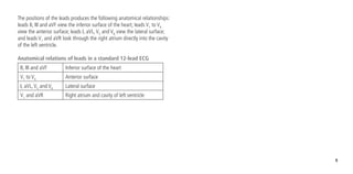 9
The positions of the leads produces the following anatomical relationships:
leads II, III and aVF view the inferior surface of the heart; leads V1
to V4
view the anterior surface; leads I, aVL,V5
and V6
view the lateral surface;
and leads V1
and aVR look through the right atrium directly into the cavity
of the left ventricle.
Anatomical relations of leads in a standard 12-lead ECG
II, III and aVF Inferior surface of the heart
V1
to V4
Anterior surface
I, aVL,V5
and V6
Lateral surface
V1
and aVR Right atrium and cavity of left ventricle
 