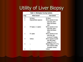 Utility of Liver Biopsy 