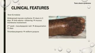 Retiform Rash BACTERIAL120INFECTIONS.pptx
