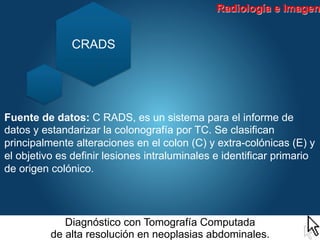 Tomografia computada alta resolución en neoplasias abdominales | PDF