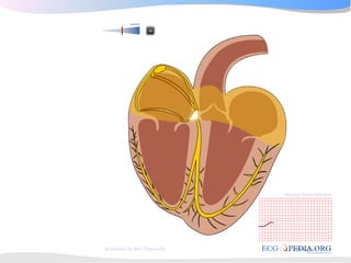 ECGpedia ECG course part I: Basic electrocardiography