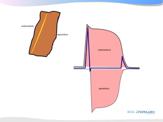 ECGpedia ECG course part I: Basic electrocardiography