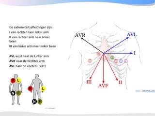 ECGpedia ECG course part I: Basic electrocardiography