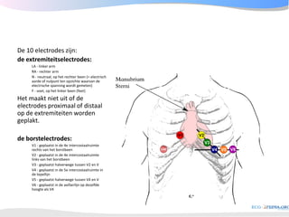 ECGpedia ECG course part I: Basic electrocardiography