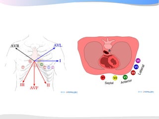ECGpedia ECG course part I: Basic electrocardiography