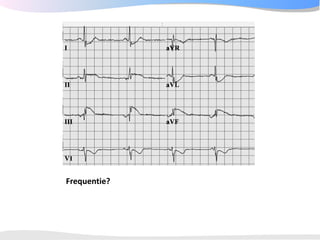 ECGpedia ECG course part I: Basic electrocardiography