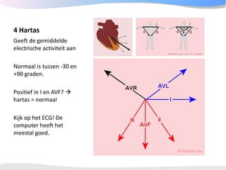 ECGpedia ECG course part I: Basic electrocardiography