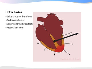 ECGpedia ECG course part I: Basic electrocardiography