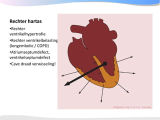 ECGpedia ECG course part I: Basic electrocardiography