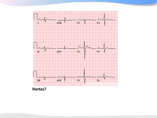 ECGpedia ECG course part I: Basic electrocardiography