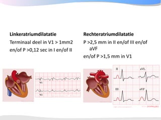 ECGpedia ECG course part I: Basic electrocardiography