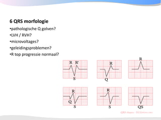 ECGpedia ECG course part I: Basic electrocardiography