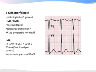 ECGpedia ECG course part I: Basic electrocardiography
