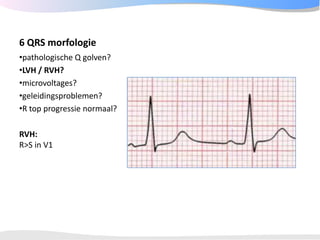 ECGpedia ECG course part I: Basic electrocardiography