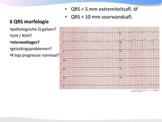 ECGpedia ECG course part I: Basic electrocardiography