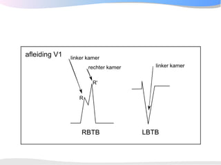 ECGpedia ECG course part I: Basic electrocardiography