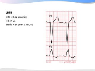 ECGpedia ECG course part I: Basic electrocardiography