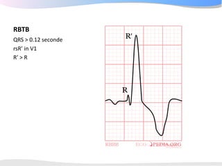 ECGpedia ECG course part I: Basic electrocardiography