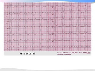 ECGpedia ECG course part I: Basic electrocardiography