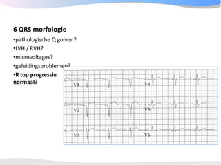 ECGpedia ECG course part I: Basic electrocardiography