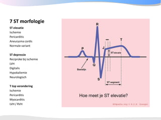 ECGpedia ECG course part I: Basic electrocardiography