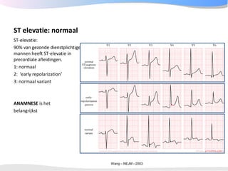 ECGpedia ECG course part I: Basic electrocardiography