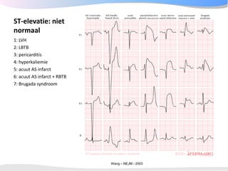 ECGpedia ECG course part I: Basic electrocardiography