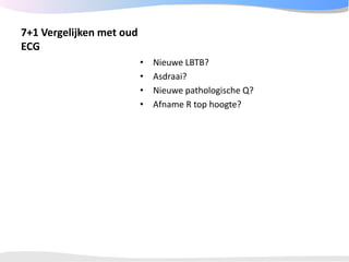 ECGpedia ECG course part I: Basic electrocardiography