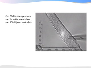 ECGpedia ECG course part I: Basic electrocardiography