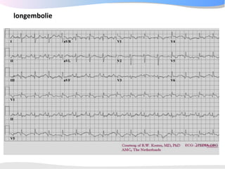 ECGpedia ECG course part I: Basic electrocardiography