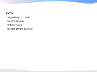 ECGpedia ECG course part I: Basic electrocardiography