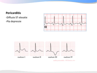 ECGpedia ECG course part I: Basic electrocardiography