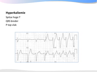 ECGpedia ECG course part I: Basic electrocardiography