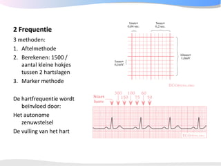 ECGpedia ECG course part I: Basic electrocardiography