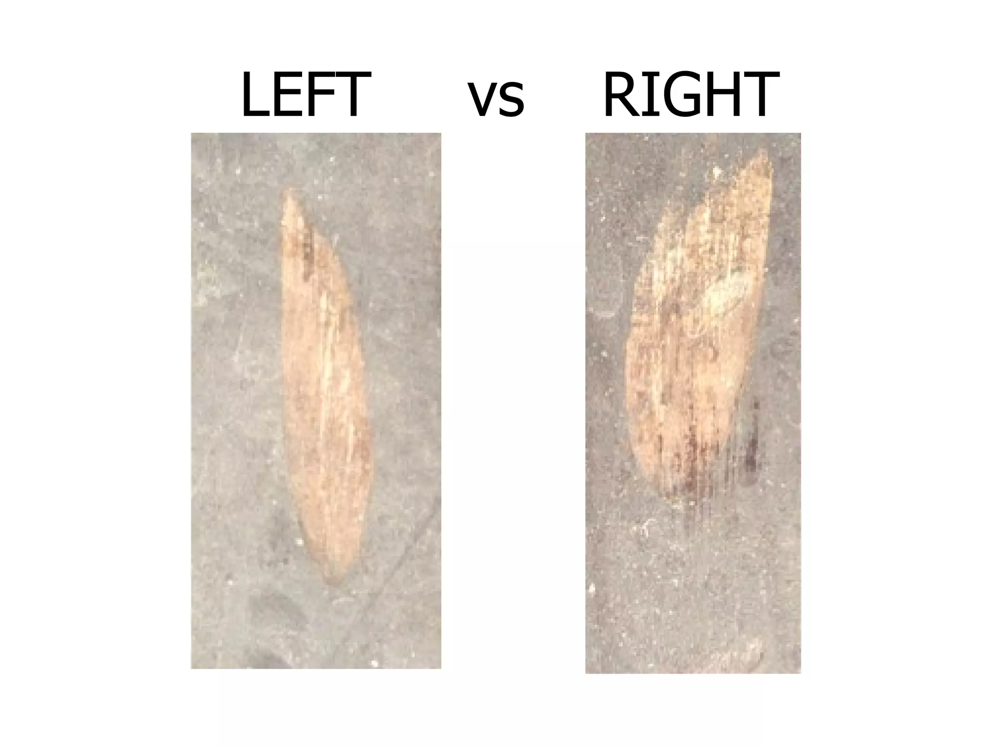 LEFT  vs  RIGHT 