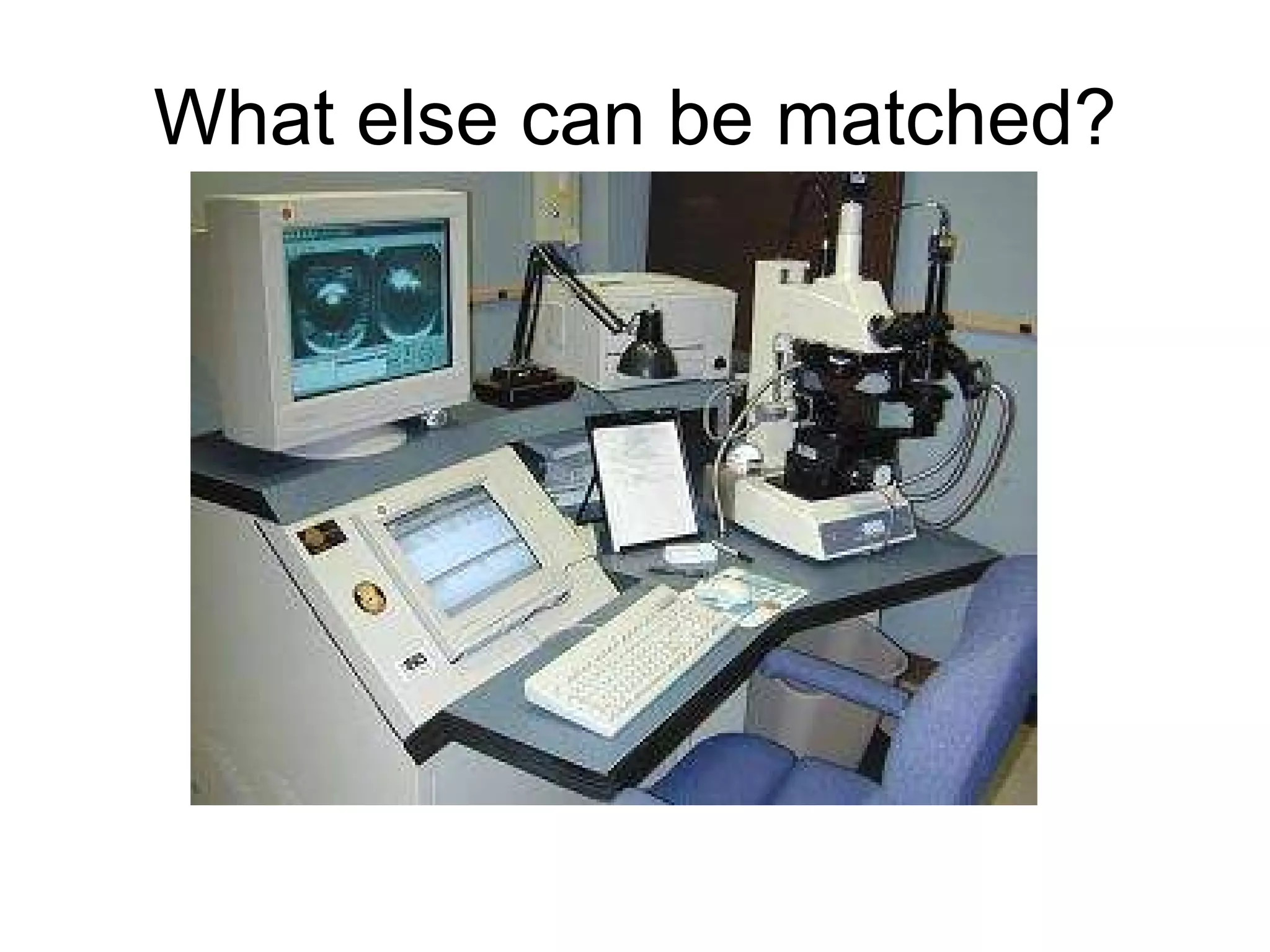 What else can be matched? 