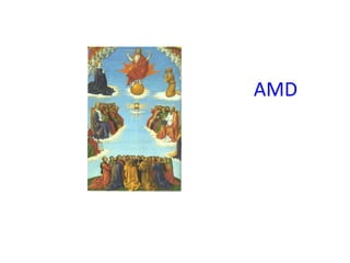 AMD 
