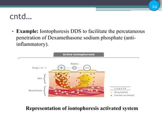 Activation Modulated Drug Delivery System | PPTX
