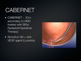 CABERNET
CABERNET - (Cnv
secondary to AMD
treated with BEta
RadiatioN Epiretinal
Therapy)
Strontium 90 + anti-
VEGF agent (Lucentis)
 