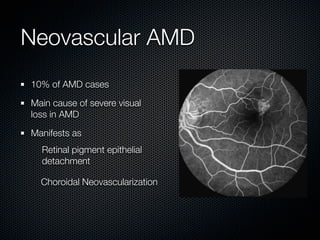 Neovascular AMD
10% of AMD cases

Main cause of severe visual
loss in AMD

Manifests as
  Retinal pigment epithelial
  detachment

  Choroidal Neovascularization
 
