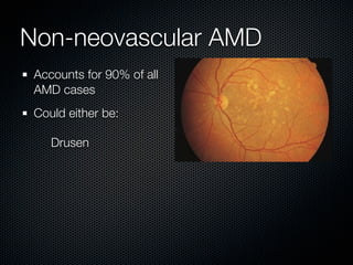 Non-neovascular AMD
 Accounts for 90% of all
 AMD cases
 Could either be:

    Drusen
 