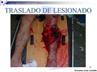 TRASLADO DE LESIONADO